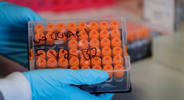 В Великобритании впервые в мире заразят добровольцев коронавирусом для испытания вакцины 