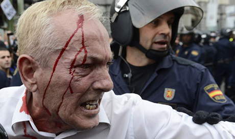 Десятки человек ранены в ходе столкновений демонстрантов с полицией в Мадриде