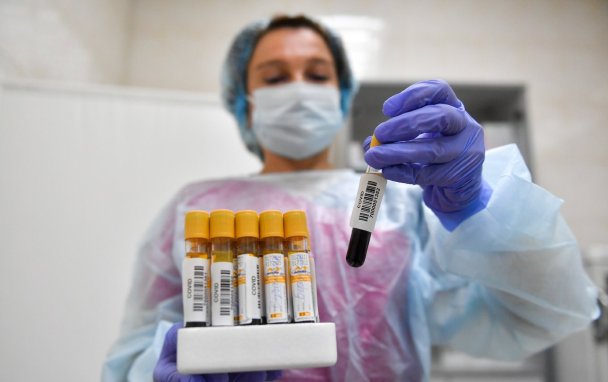 В России второй день подряд выявили меньше 10 000 заболевших коронавирусом