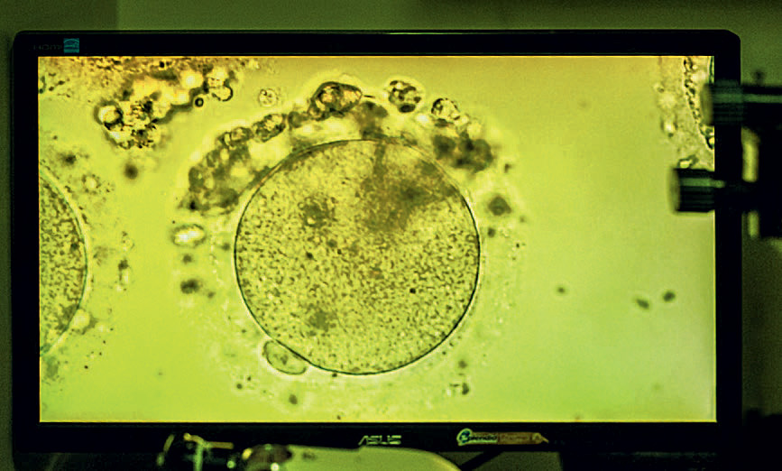 Яйцеклетка фото под микроскопом