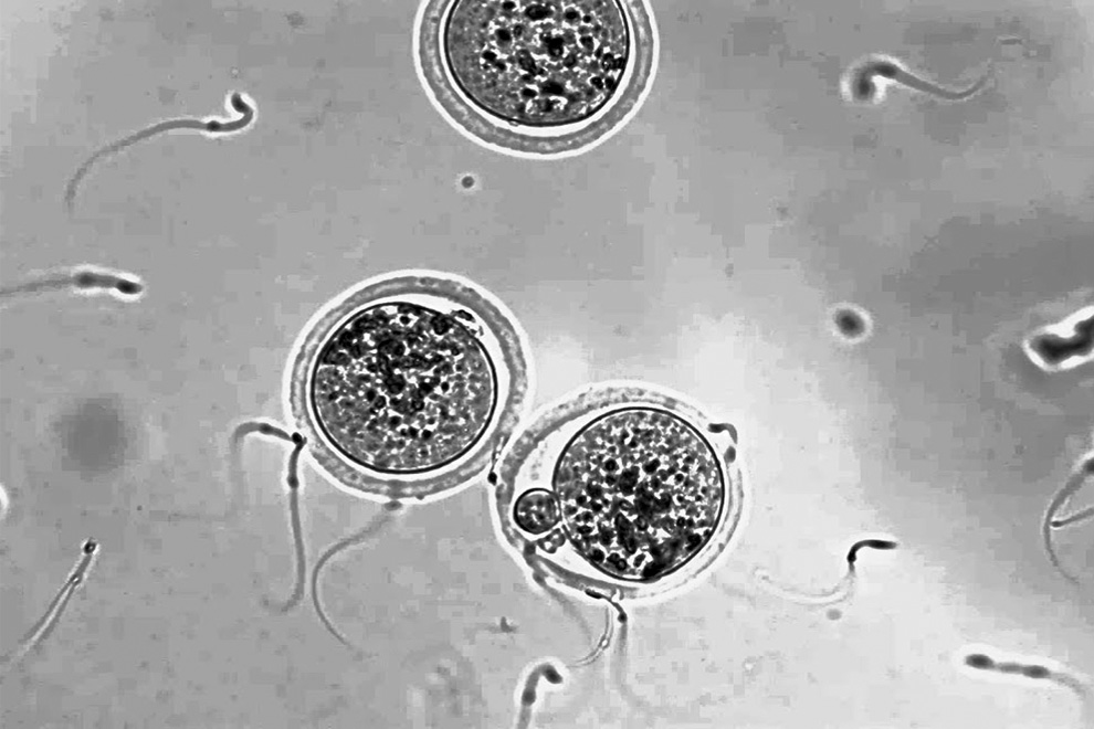 Сперматозоиды умирают друг за друга - заточка63.рф