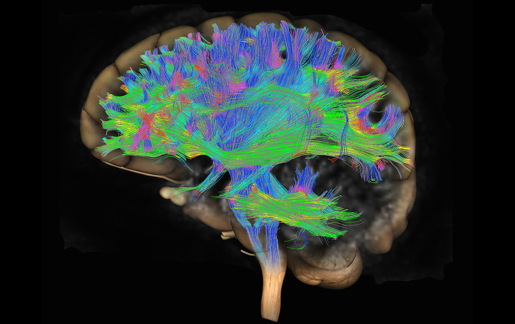 Imaging source. Diffusion Tensor Imaging (DTI). Трактография мрт. Трактография головного мозга. Мрт трактография головного мозга.