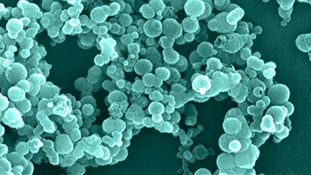 Размер нанобактерий — 50–300 нм — не превышает размера мелких вирусов, что в большинстве случаев недостаточно, чтобы вместить даже самые необходимые для жизни ферменты, такие как комплекс репликации ДНК. В связи с этим нанобактерии можно разглядеть только в электронный микроскоп — а следовательно, увидеть эти загадочные частицы «живьем» шансов нет ( Фото обложки журнала PNAS (#105, 2008))