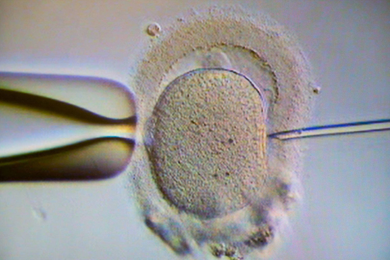 Криоконсервация эмбрионов, яйцеклеток, спермы