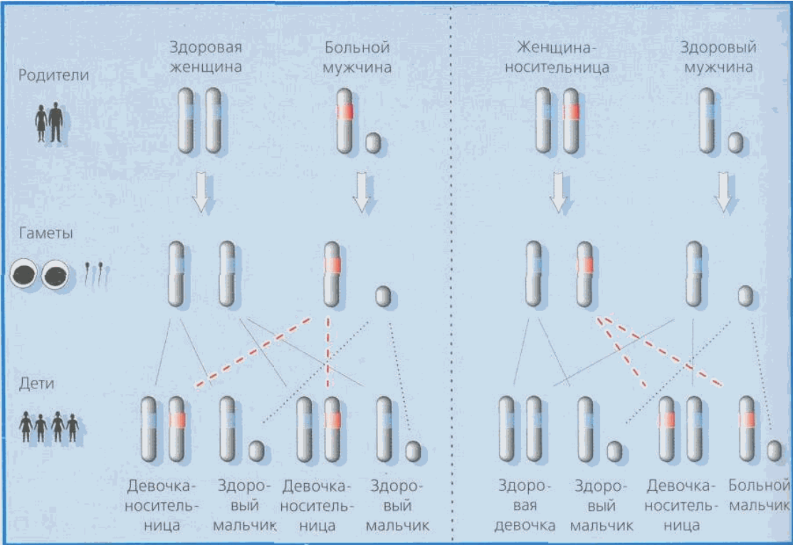 Мужская и царская болезнь: пять мифов о гемофилии, которые давно  опровергнуты наукой | Forbes Life