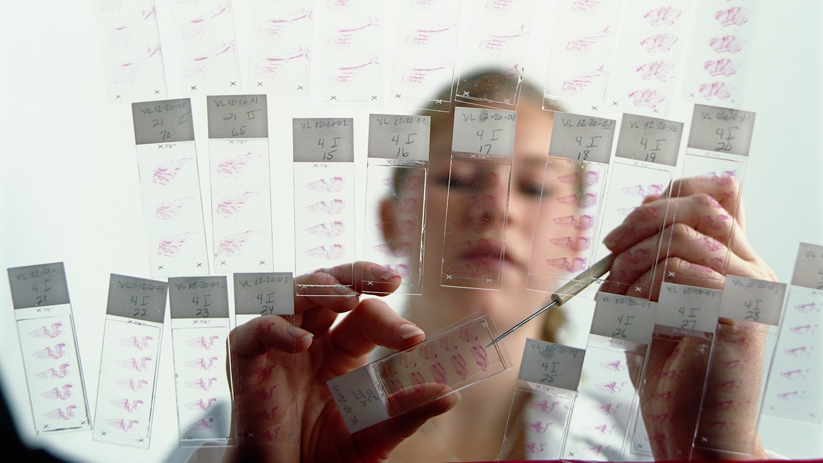 Уровень заболеваемости раком вырос среди миллениалов и поколения X