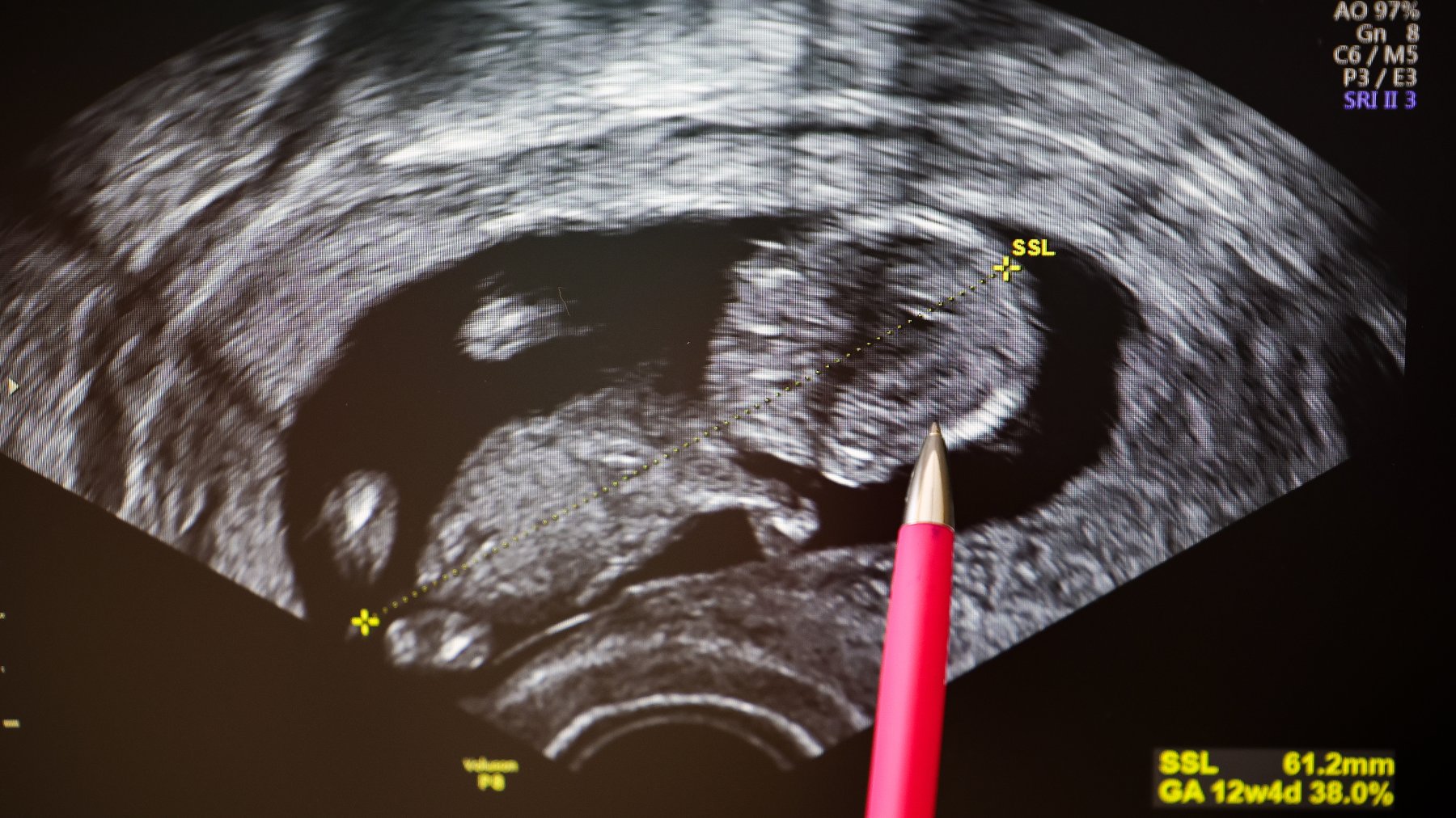В Омской области ввели штрафы за склонение к абортам