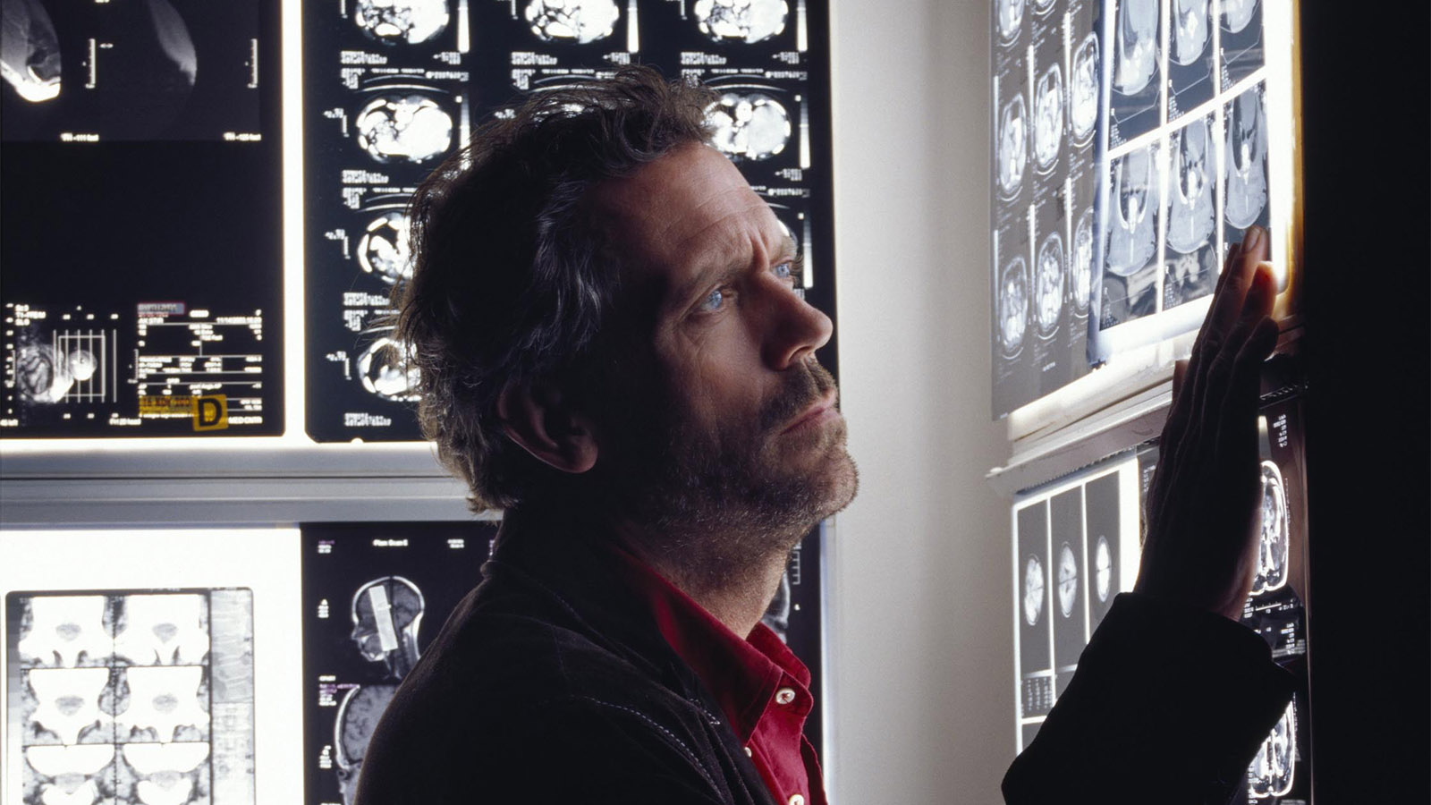 Кажется, это волчанка: как сериалы про врачей завоевали любовь телезрителей