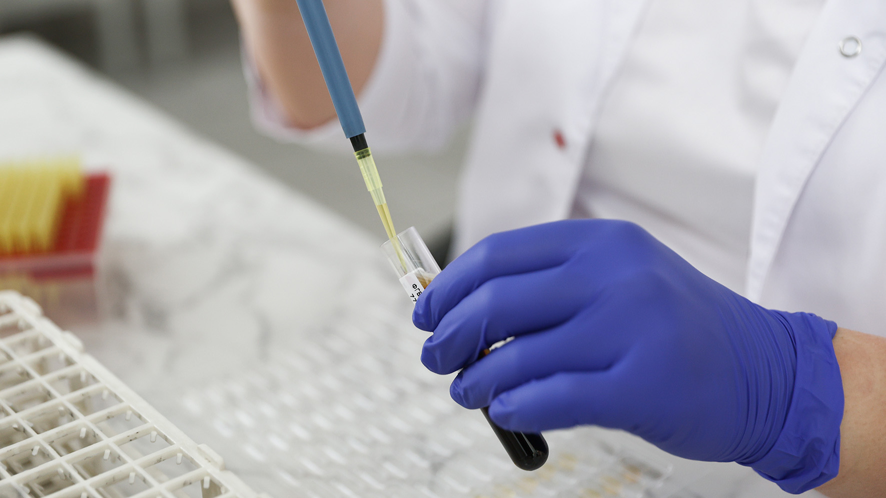 Роспотребнадзор запустил горячую линию по вопросам профилактики ВИЧ