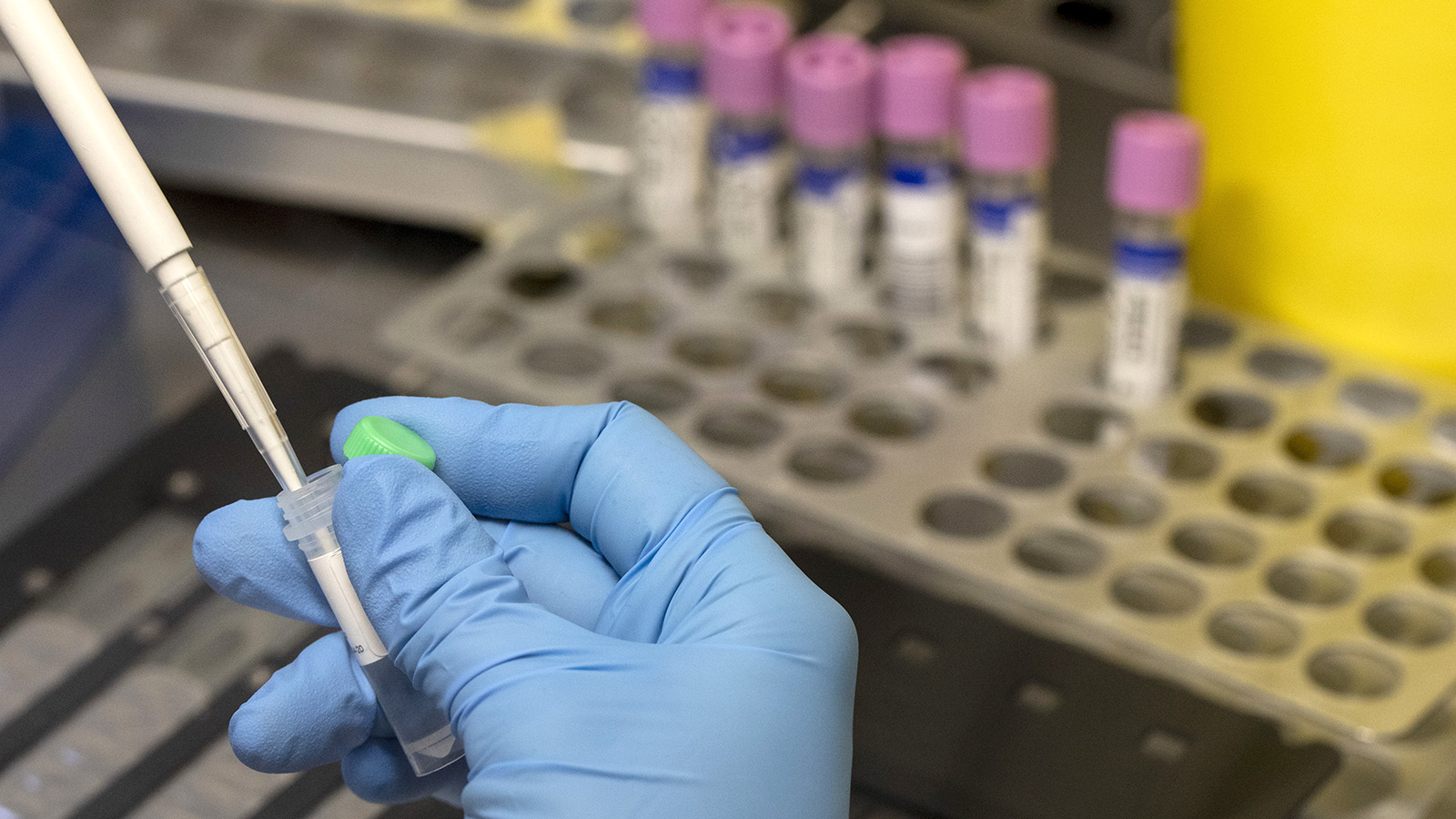 Вирус по контакту: в чем опасность выявленной в Подмосковье оспы обезьян