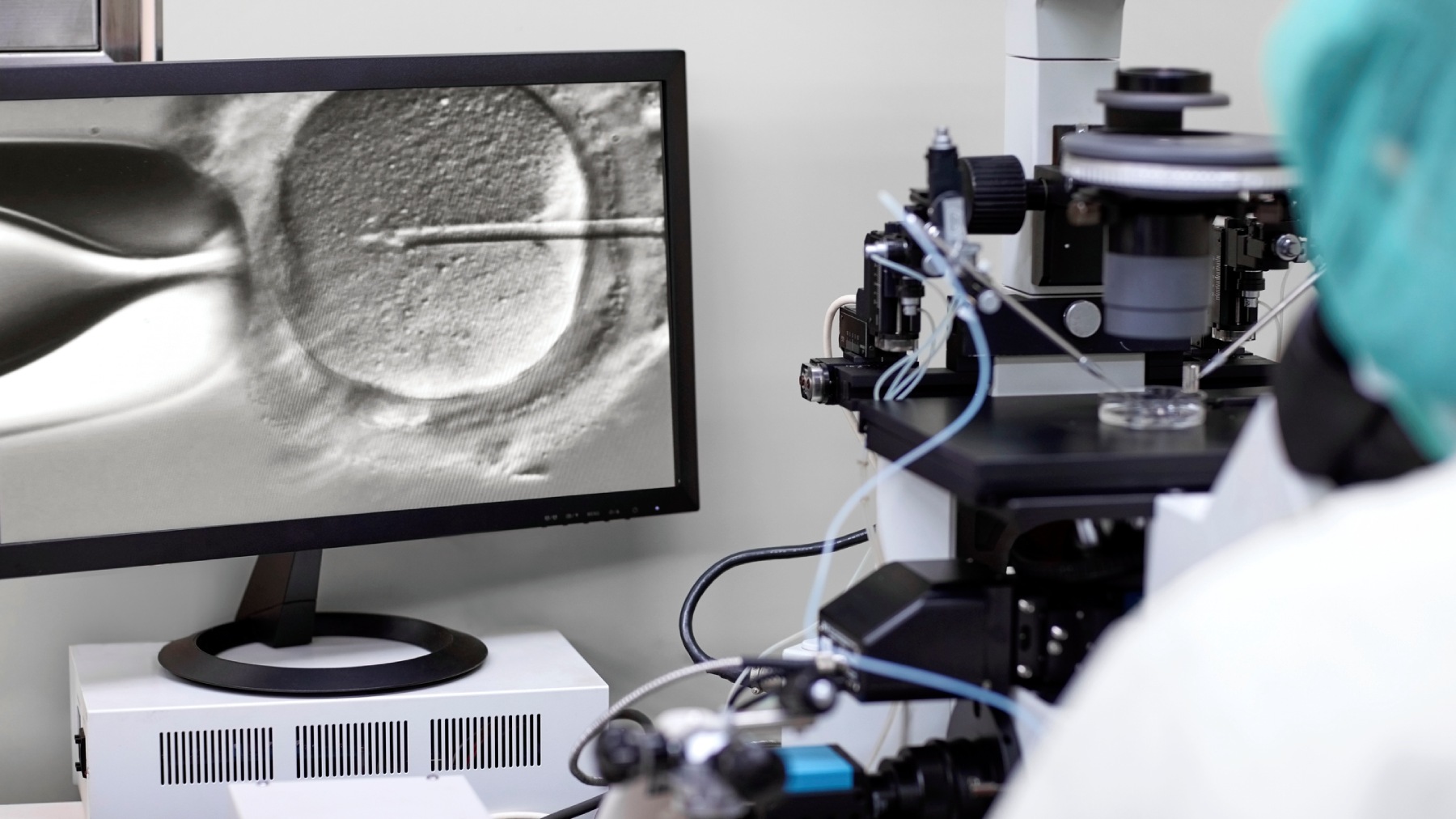 В 2026 году число процедур ЭКО в России планируется увеличить на 15%